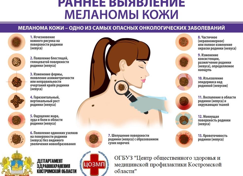 Как мы подкрановую площадку с регучёта снимали, часть 2, Сибирское Управление Ростехнадзора