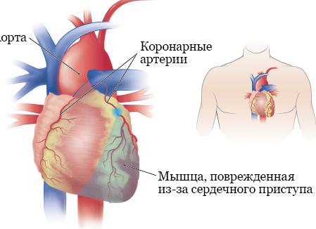 Сколько должно умереть, чтоб запретили езду без номеров?